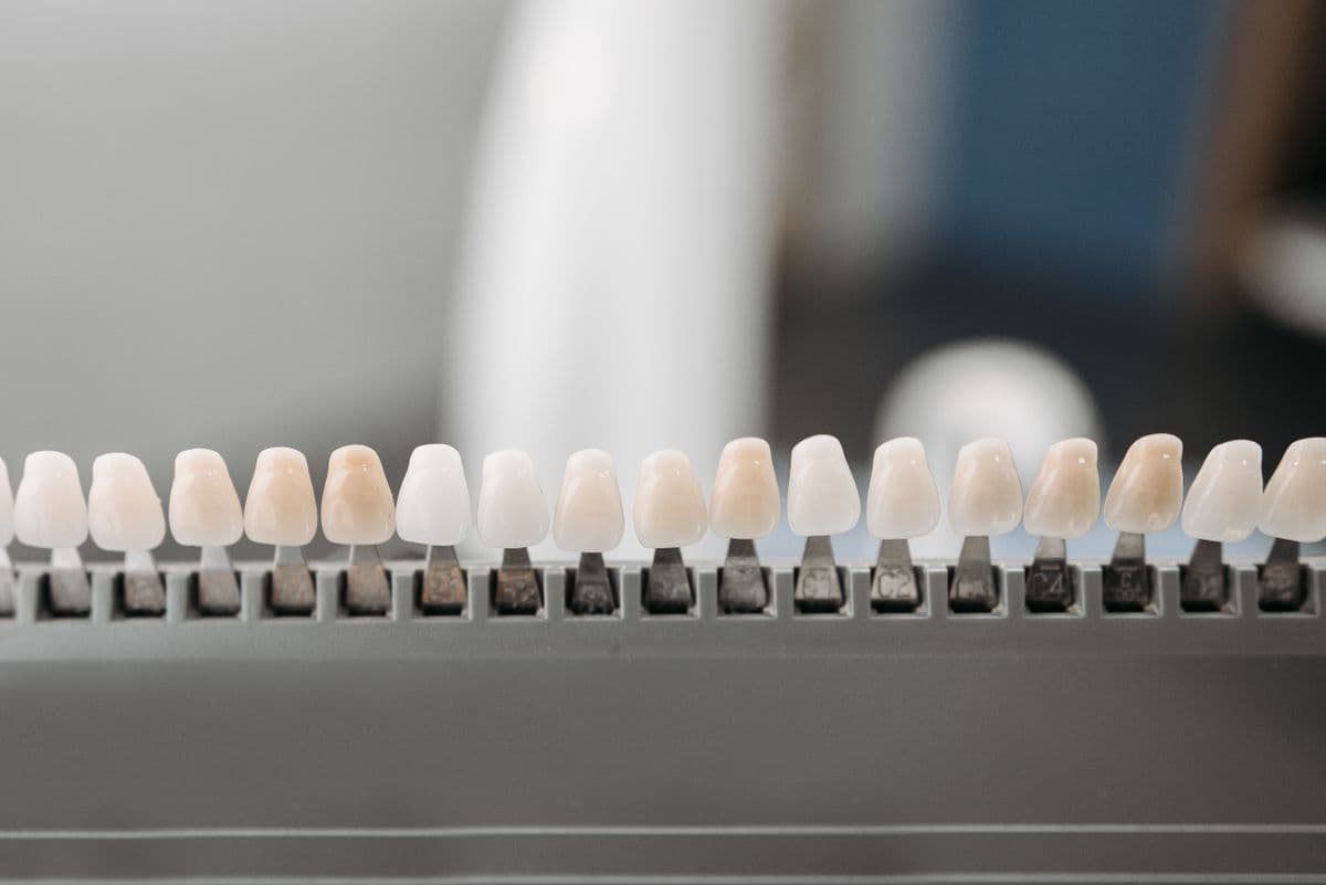 Teeth Whitening: A Complete Guide to a Brighter Smile