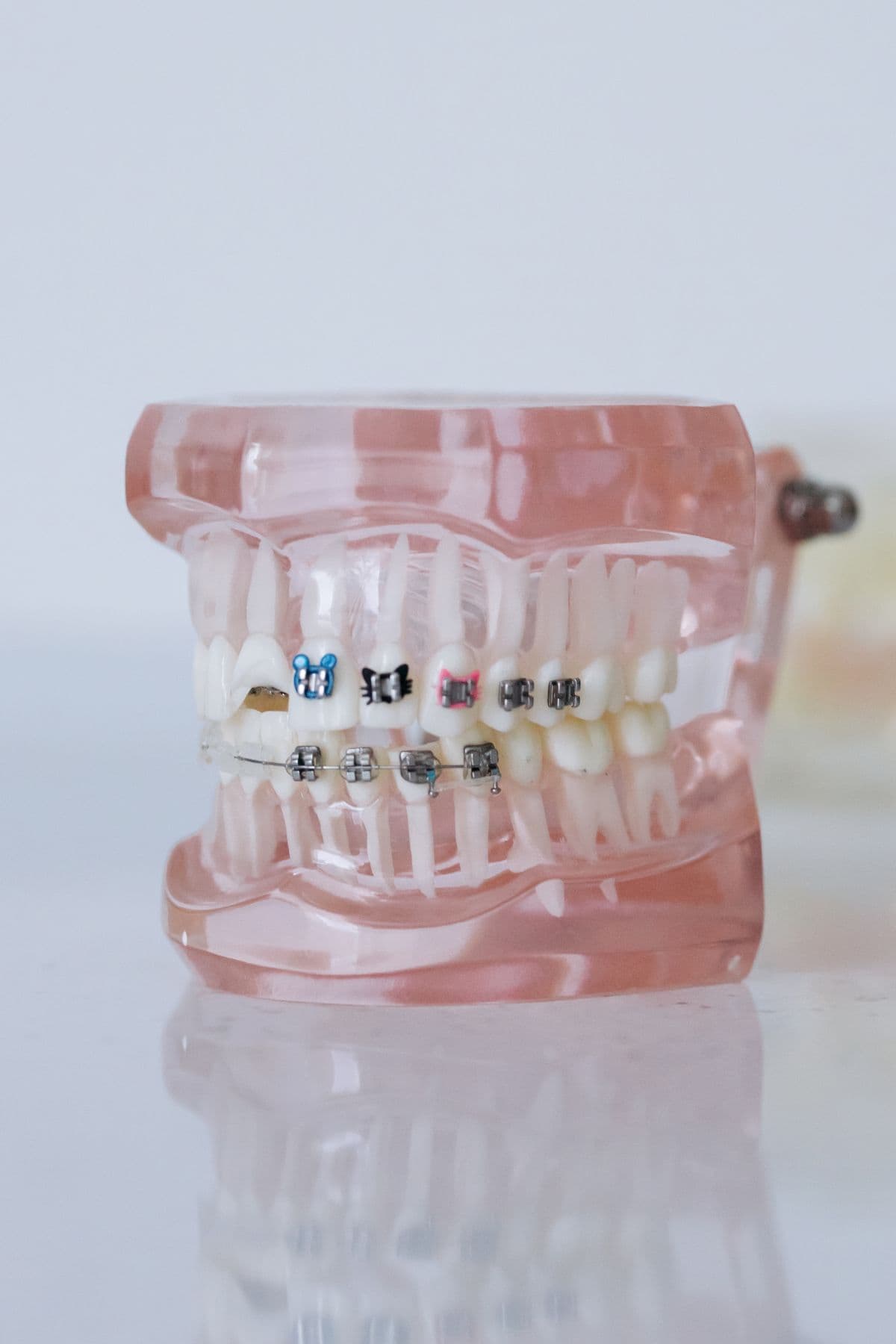 Understanding Tooth Malalignment: A Guide to Orthodontic Solutions